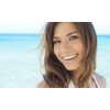 $39 for a Single Led Teeth-Whitening Treatment ($129 Value)